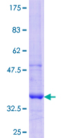 ab160400 on a 12.5% SDS-PAGE stained with Coomassie Blue.