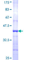 ab158213 on a 12.5% SDS-PAGE stained with Coomassie Blue.