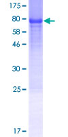 ab162855 on a 12.5% SDS-PAGE stained with Coomassie Blue.