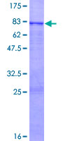 ab158512 on a 12.5% SDS-PAGE stained with Coomassie Blue.