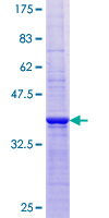 ab158513 on a 12.5% SDS-PAGE stained with Coomassie Blue.