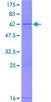 ab166166 on a 12.5% SDS-PAGE stained with Coomassie Blue.