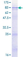 ab162863 on a 12.5% SDS-PAGE stained with Coomassie Blue.