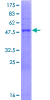 ab163992 on a 12.5% SDS-PAGE stained with Coomassie Blue.