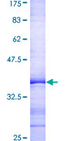 ab158511 on a 12.5% SDS-PAGE stained with Coomassie Blue.