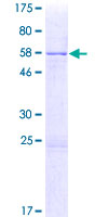 ab159548 on a 12.5% SDS-PAGE stained with Coomassie Blue.