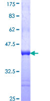 ab162348 on a 12.5% SDS-PAGE stained with Coomassie Blue.