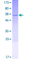 ab162913 on a 12.5% SDS-PAGE stained with Coomassie Blue.