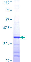 ab153064 on a 12.5% SDS-PAGE stained with Coomassie Blue.