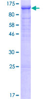 ab159296 on a 12.5% SDS-PAGE stained with Coomassie Blue.