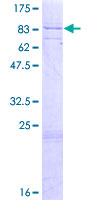 ab164346 on a 12.5% SDS-PAGE stained with Coomassie Blue.