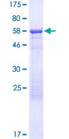 ab166534 on a 12.5% SDS-PAGE stained with Coomassie Blue.