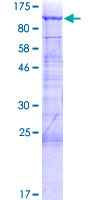 ab165850 on a 12.5% SDS-PAGE stained with Coomassie Blue.