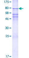 ab158516 on a 12.5% SDS-PAGE stained with Coomassie Blue.