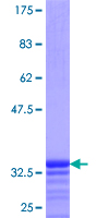 ab158517 on a 12.5% SDS-PAGE stained with Coomassie Blue.