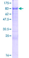 ab165228 on a 12.5% SDS-PAGE stained with Coomassie Blue.