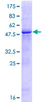 ab164889 on a 12.5% SDS-PAGE stained with Coomassie Blue.