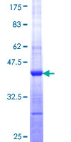 ab164603 on a 12.5% SDS-PAGE stained with Coomassie Blue.