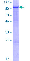ab165683 on a 12.5% SDS-PAGE stained with Coomassie Blue.