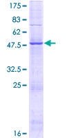 ab162852 on a 12.5% SDS-PAGE stained with Coomassie Blue.