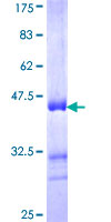 ab165251 on a 12.5% SDS-PAGE stained with Coomassie Blue.