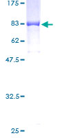 ab160666 on a 12.5% SDS-PAGE stained with Coomassie Blue.