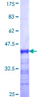 ab160667 on a 12.5% SDS-PAGE stained with Coomassie Blue.