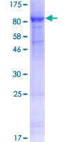 ab158520 on a 12.5% SDS-PAGE stained with Coomassie Blue.