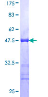 ab158521 on a 12.5% SDS-PAGE stained with Coomassie Blue.