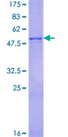 ab158524 on a 12.5% SDS-PAGE stained with Coomassie Blue.