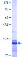 ab161163 on a 12.5% SDS-PAGE stained with Coomassie Blue.