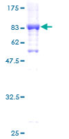 ab158527 on a 12.5% SDS-PAGE stained with Coomassie Blue.