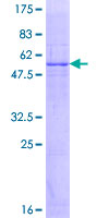 ab166061 on a 12.5% SDS-PAGE stained with Coomassie Blue.