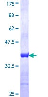 ab166062 on a 12.5% SDS-PAGE stained with Coomassie Blue.