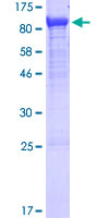 ab160765 on a 12.5% SDS-PAGE stained with Coomassie Blue.
