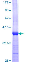 ab160766 on a 12.5% SDS-PAGE stained with Coomassie Blue.