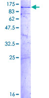 ab158531 on a 12.5% SDS-PAGE stained with Coomassie Blue.