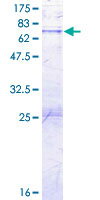 ab158532 on a 12.5% SDS-PAGE stained with Coomassie Blue.