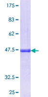ab158533 on a 12.5% SDS-PAGE stained with Coomassie Blue.