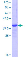 ab161239 on a 12.5% SDS-PAGE stained with Coomassie Blue.