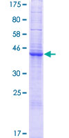 ab166069 on a 12.5% SDS-PAGE stained with Coomassie Blue.
