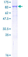 ab161321 on a 12.5% SDS-PAGE stained with Coomassie Blue.