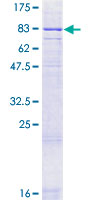 ab160439 on a 12.5% SDS-PAGE stained with Coomassie Blue.