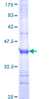 ab160440 on a 12.5% SDS-PAGE stained with Coomassie Blue.