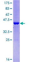ab164144 on a 12.5% SDS-PAGE stained with Coomassie Blue.