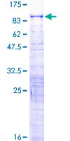 ab162307 on a 12.5% SDS-PAGE stained with Coomassie Blue.