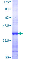 ab162308 on a 12.5% SDS-PAGE stained with Coomassie Blue.