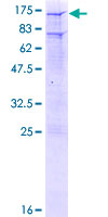 ab158585 on a 12.5% SDS-PAGE stained with Coomassie Blue.
