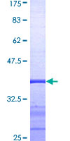 ab158586 on a 12.5% SDS-PAGE stained with Coomassie Blue.