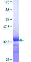 ab164312 on a 12.5% SDS-PAGE stained with Coomassie Blue.